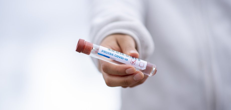 Test tube in the hand of a doctor